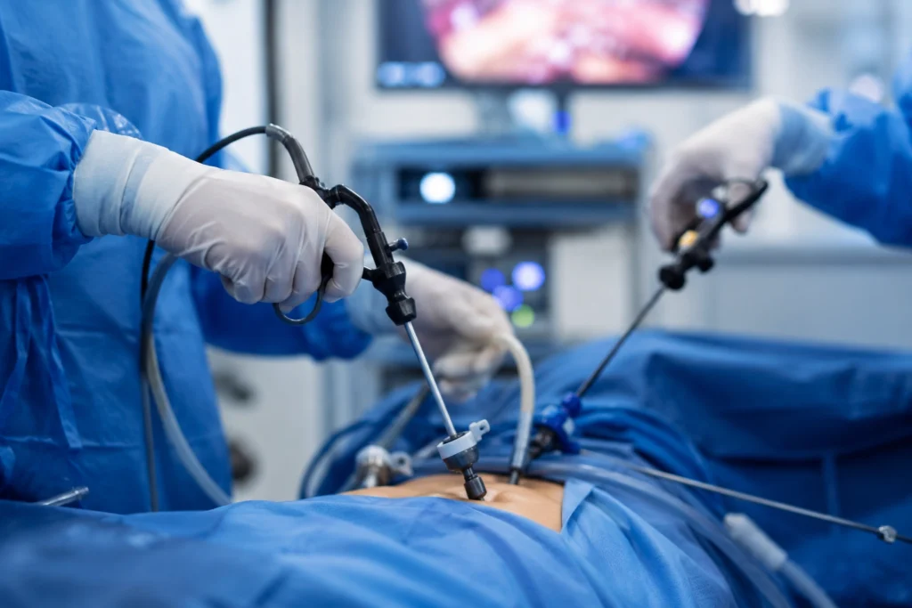 Laparoscopic surgery